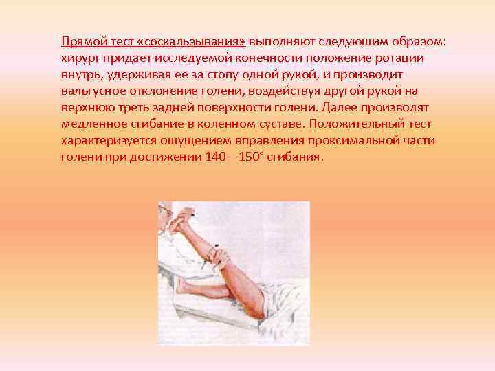Прямой тест «соскальзывания» выполняют следующим образом: хирург придает исследуемой конечности положение ротации внутрь, удерживая