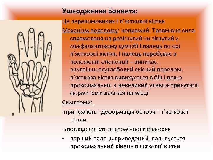 Ушкодження Боннета: Це переломовивих I п’ясткової кістки Механізм перелому: непрямий. Травмівна сила спрямована на