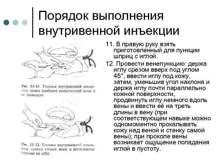 Порядок выполнения внутривенной инъекции 11. В правую руку взять приготовленный для пункции шприц с