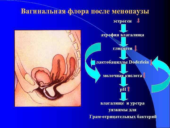 Вагинальная флора после менопаузы эстроген атрофия влагалища гликоген лактобациллы Doderlein молочная кислота р. Н