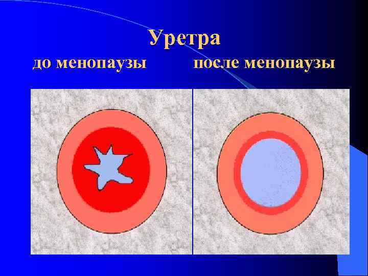 Уретра до менопаузы после менопаузы 