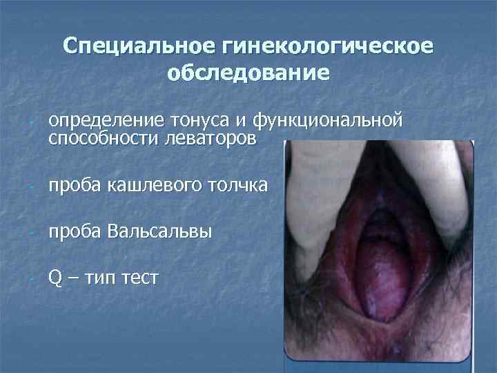  Специальное гинекологическое   обследование -  определение тонуса и функциональной способности леваторов
