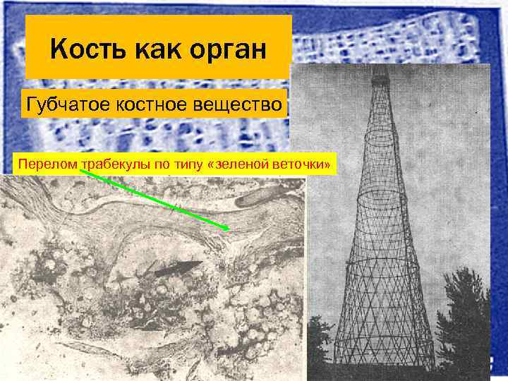   Кость как орган Губчатое вещество кости     Линии напряжения