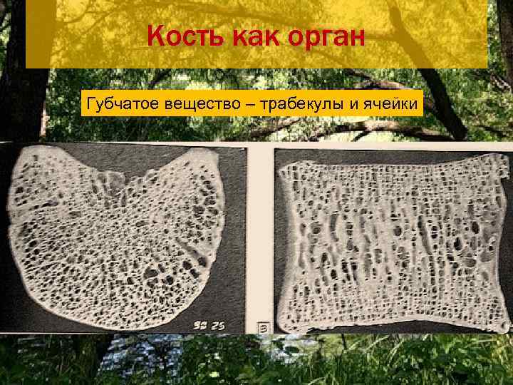   Кость как орган Губчатое костное вещество Перелом трабекулы по типу «зеленой веточки»