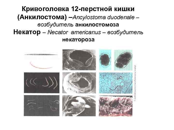 Кривоголовка 12 -перстной кишки (Анкилостома) –Ancylostoma duodenale – возбудитель анкилостомоза Некатор – Кривоголовка 12 -перстной кишки (Анкилостома) –Ancylostoma duodenale – возбудитель анкилостомоза Некатор –