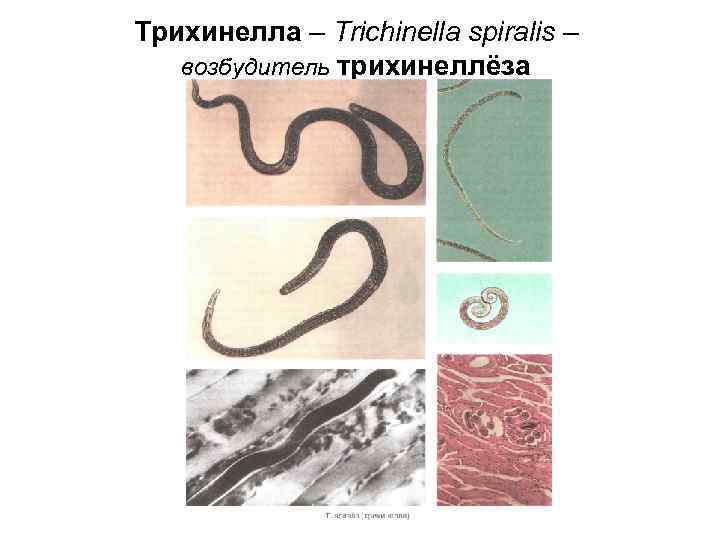 Трихинелла – Trichinella spiralis – возбудитель трихинеллёза Трихинелла – Trichinella spiralis – возбудитель трихинеллёза