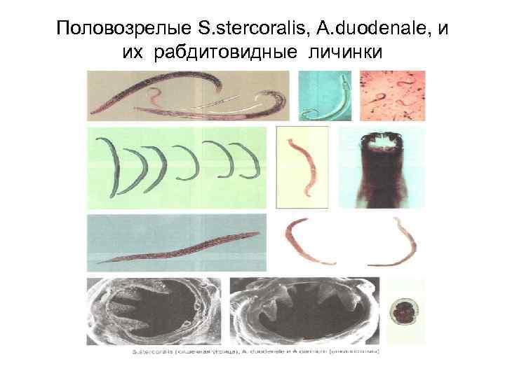 Половозрелые S. stercoralis, A. duodenale, и их рабдитовидные личинки Половозрелые S. stercoralis, A. duodenale, и их рабдитовидные личинки