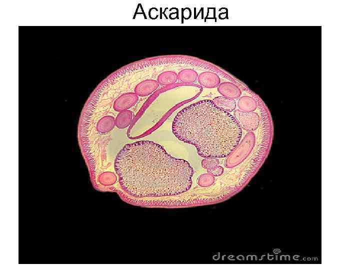 Аскарида Аскарида