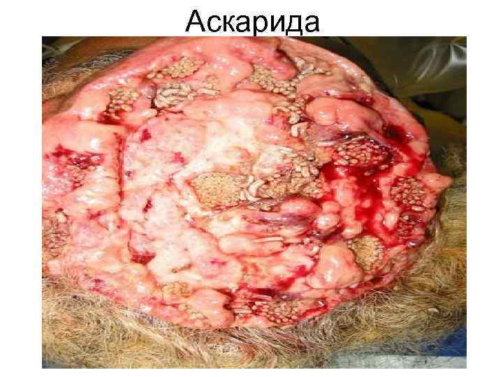 Аскарида Аскарида