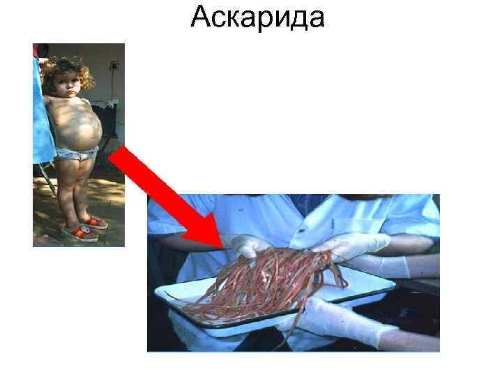 Аскарида Аскарида