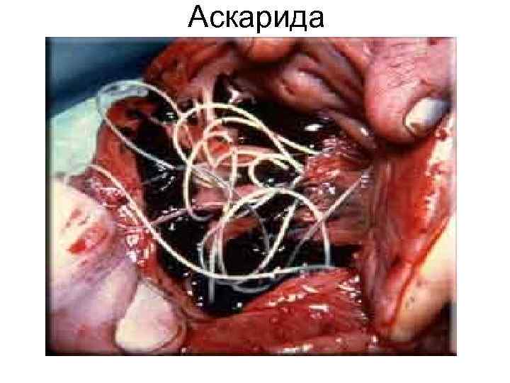 Аскарида Аскарида