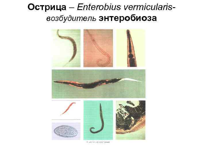 Острица – Enterobius vermiсularis- возбудитель энтеробиоза Острица – Enterobius vermiсularis- возбудитель энтеробиоза