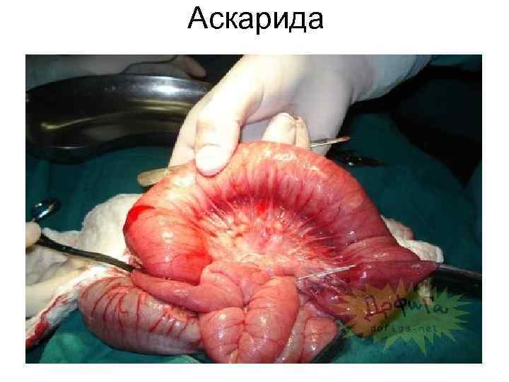 Аскарида Аскарида