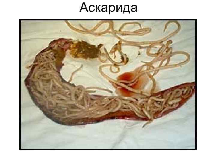 Аскарида Аскарида