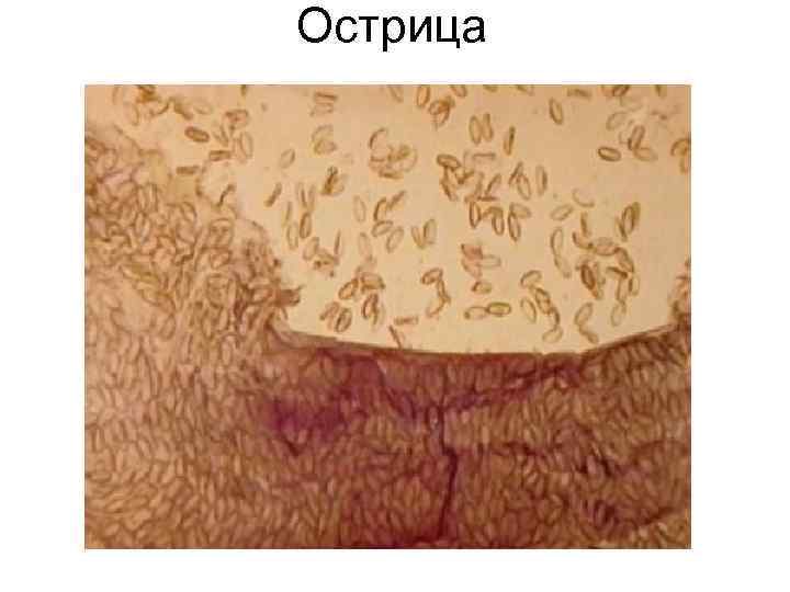 Острица Острица