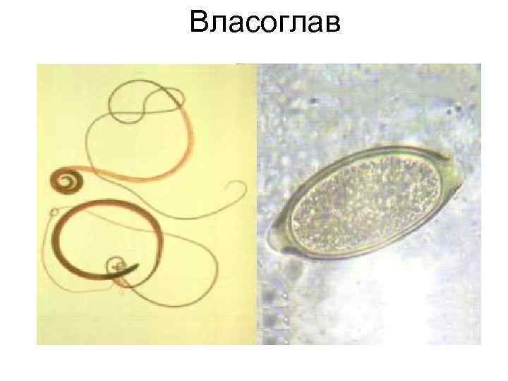 Власоглав Власоглав