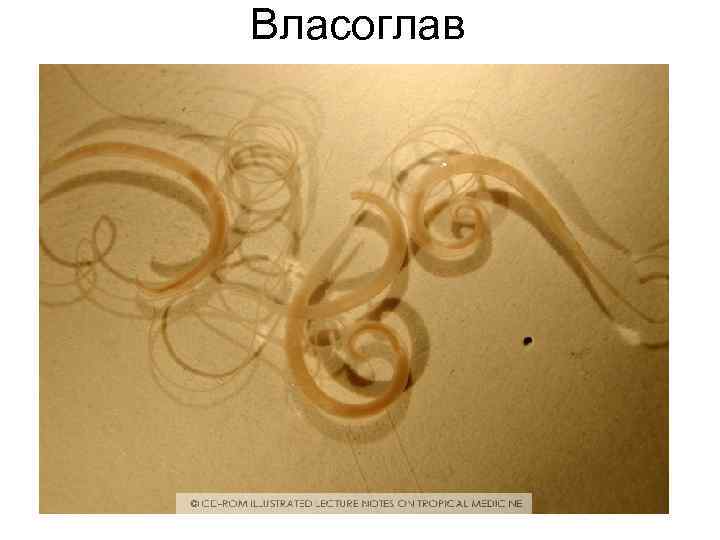 Власоглав Власоглав