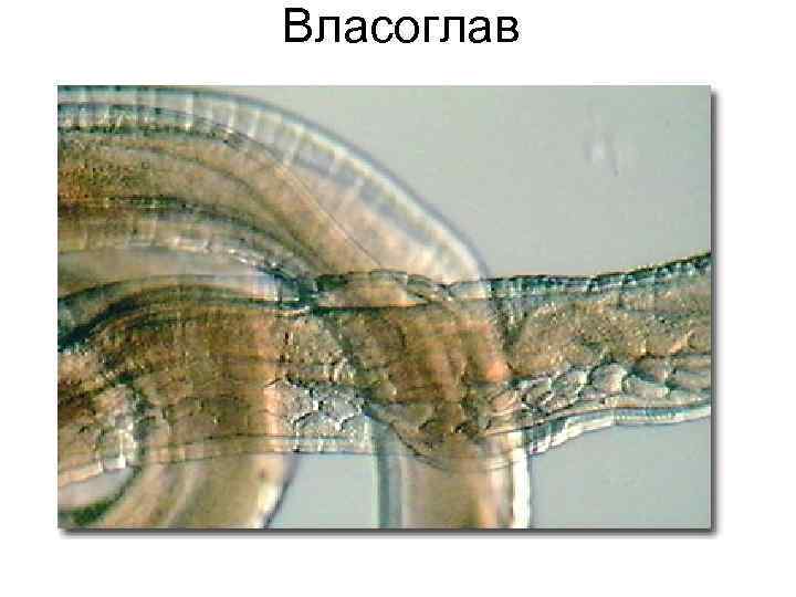 Власоглав Власоглав