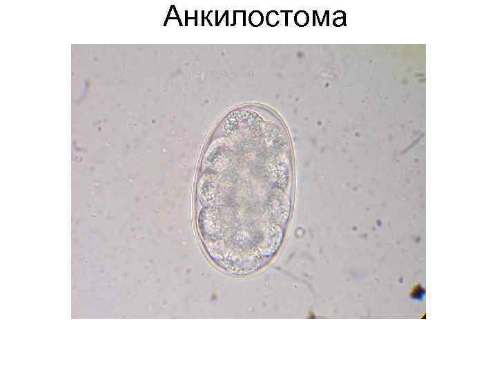 Анкилостома Анкилостома