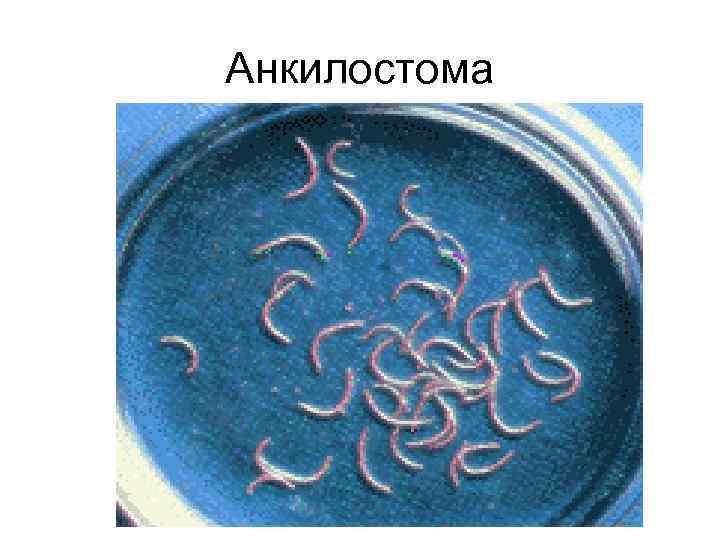Анкилостома Анкилостома