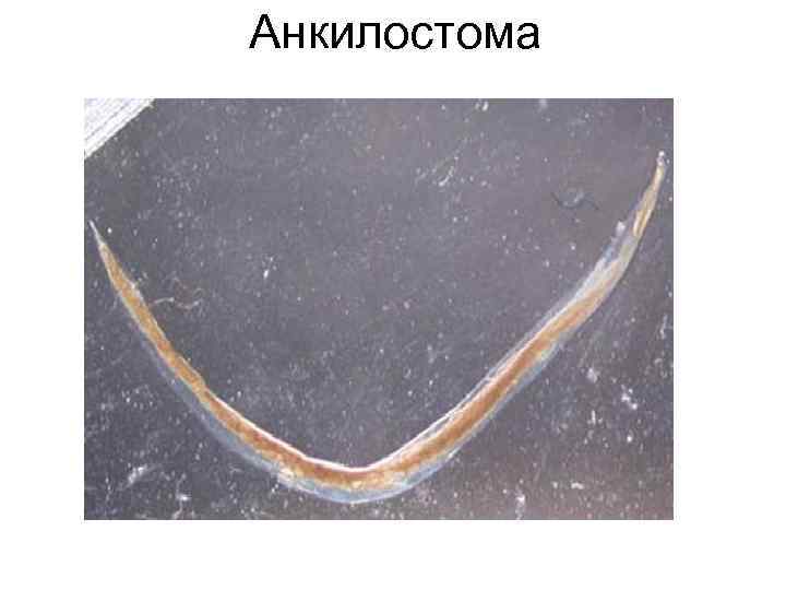 Анкилостома Анкилостома