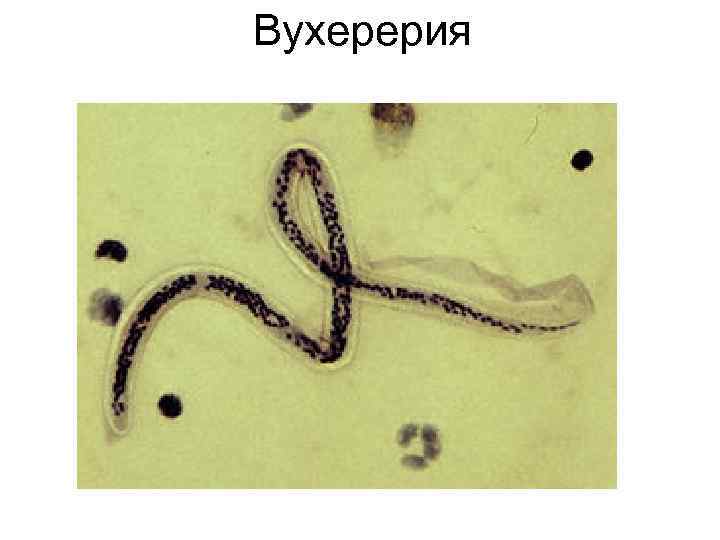 Вухерерия Вухерерия