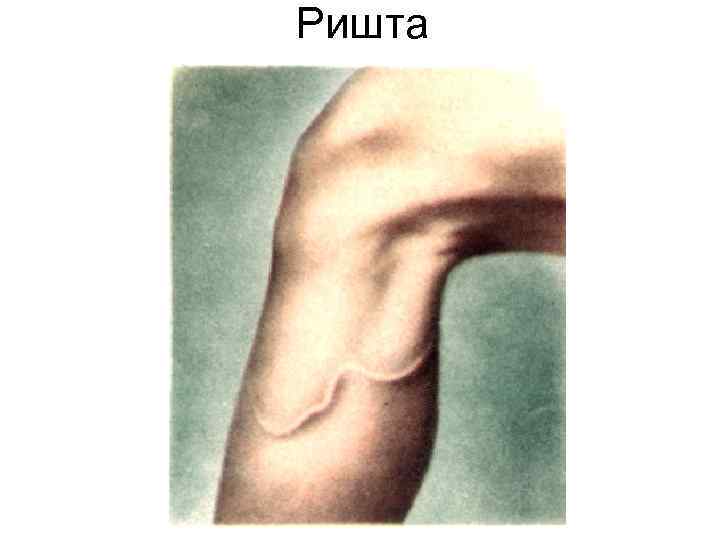 Ришта Ришта