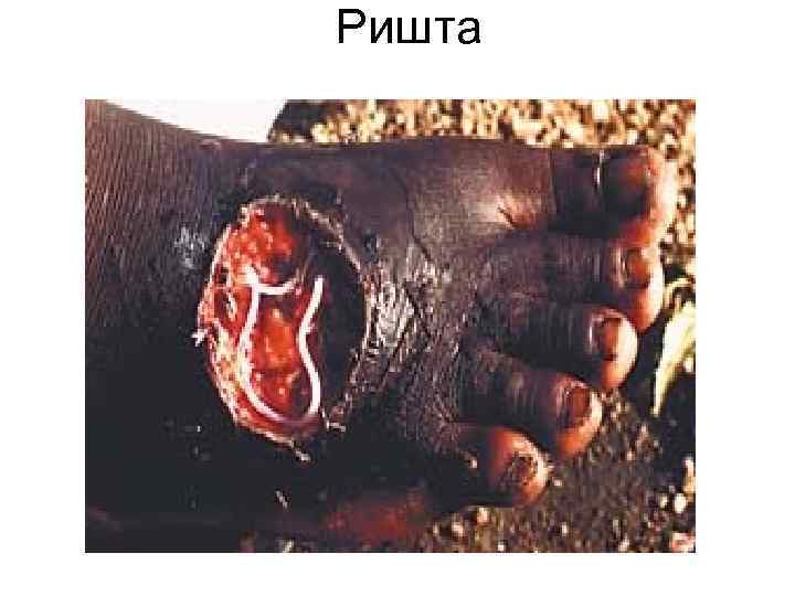 Ришта Ришта