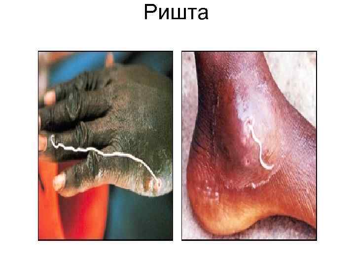 Ришта Ришта