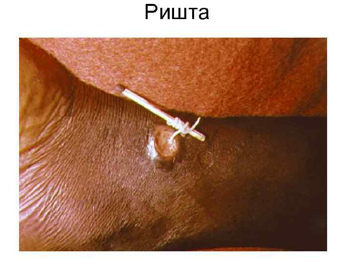 Ришта Ришта