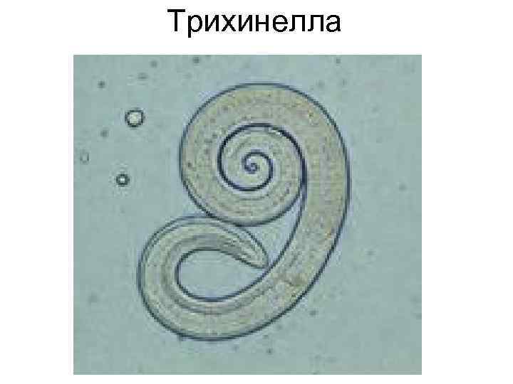 Трихинелла Трихинелла