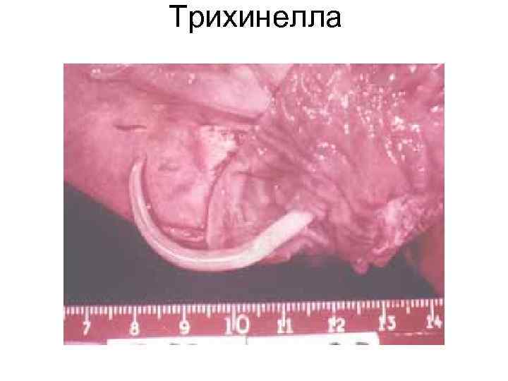 Трихинелла Трихинелла
