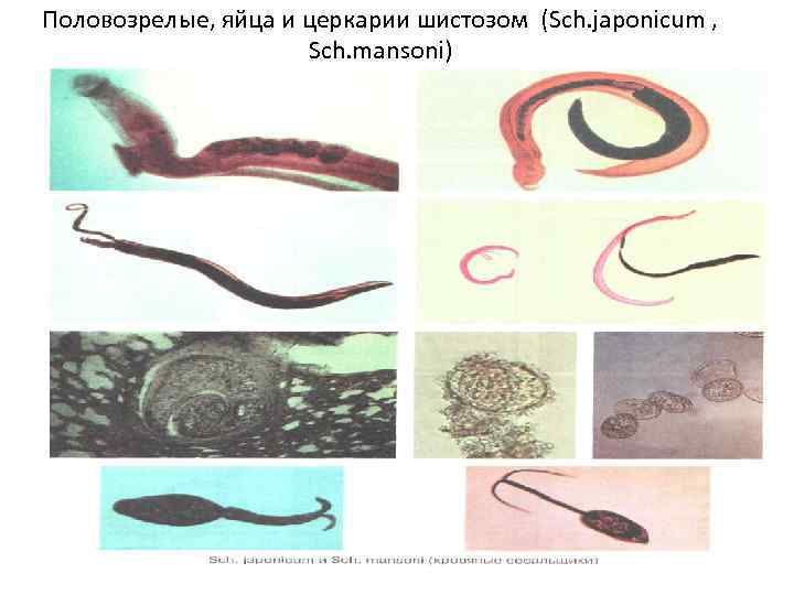 Половозрелые, яйца и церкарии шистозом (Sch. japonicum ,    Sch. mansoni) 