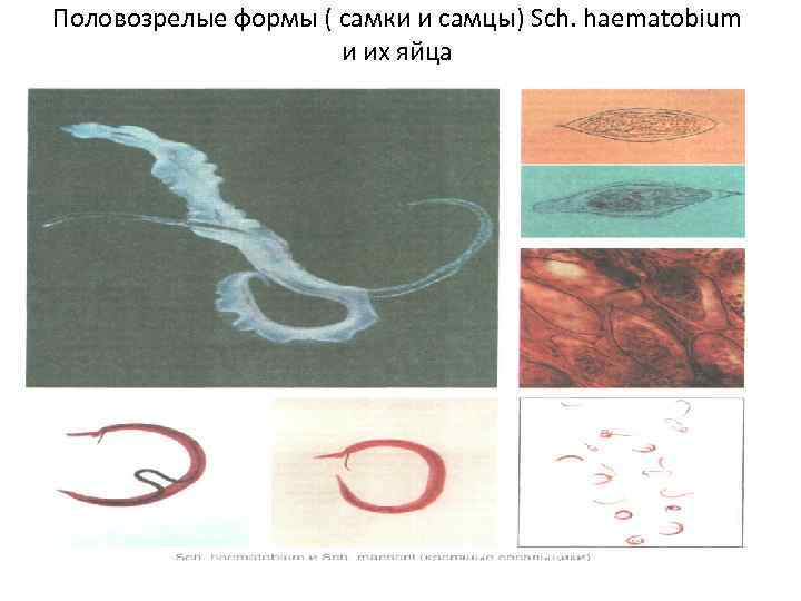 Половозрелые формы ( самки и самцы) Sch. haematobium    и их яйца