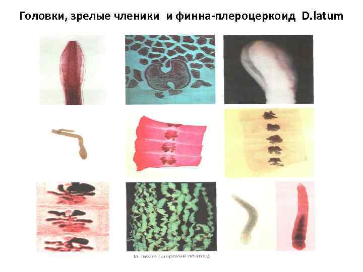 Головки, зрелые членики и финна-плероцеркоид D. latum 