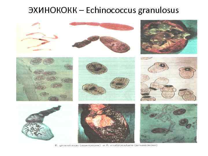 ЭХИНОКОКК – Echinococcus granulosus 