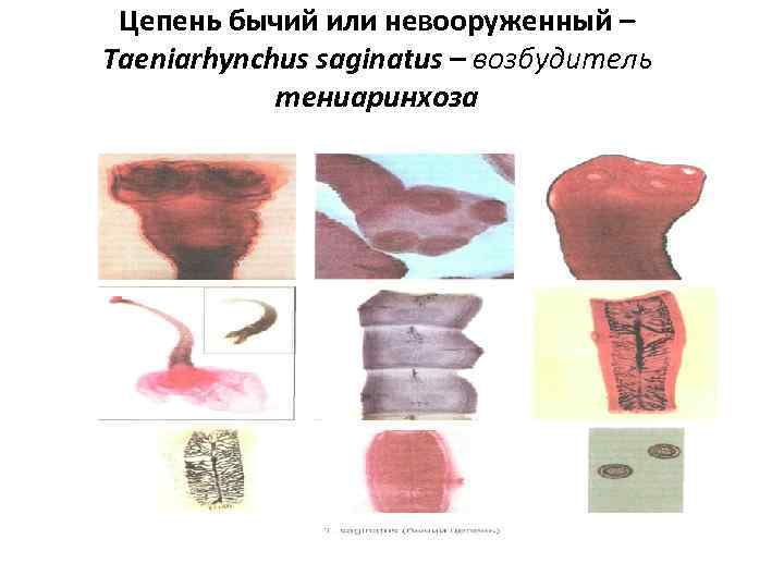  Цепень бычий или невооруженный – Taeniarhynchus saginatus – возбудитель   тениаринхоза 