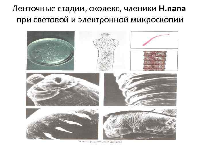 Ленточные стадии, сколекс, членики H. nana  при световой и электронной микроскопии 