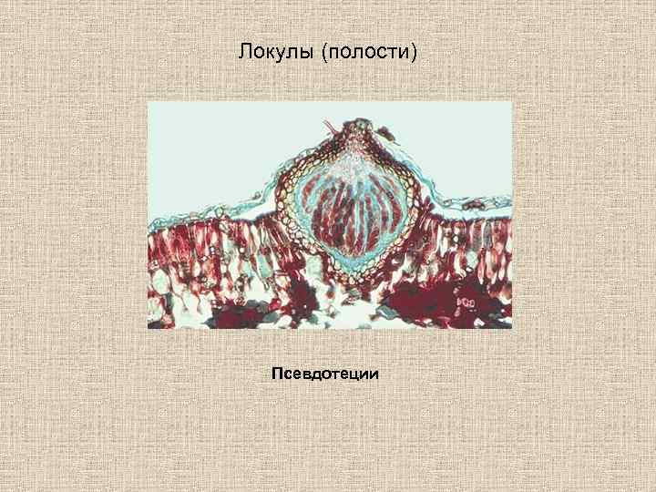 Локулы (полости) Псевдотеции 
