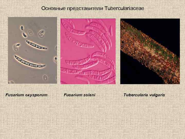 Основные представители Tuberculariaceae Fusarium oxysporum Fusarium solani Tubercularia vulgaris 