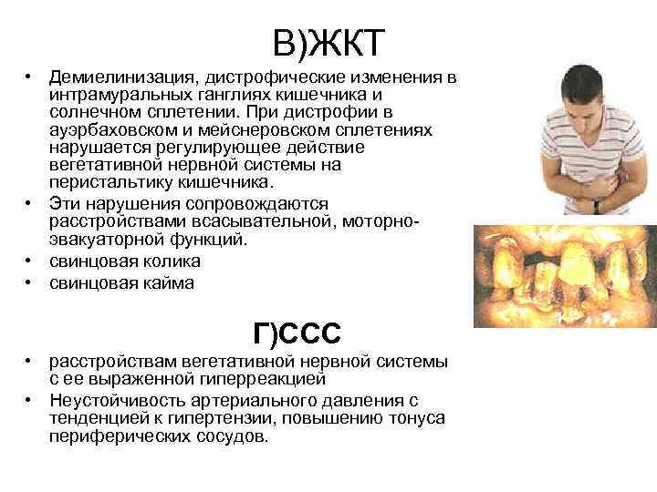      В)ЖКТ • Демиелинизация, дистрофические изменения в  интрамуральных ганглиях