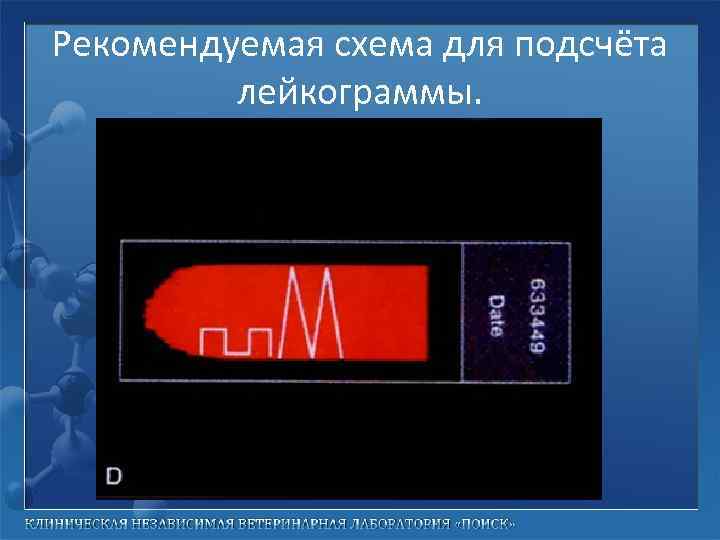 Рекомендуемая схема для подсчёта лейкограммы. 