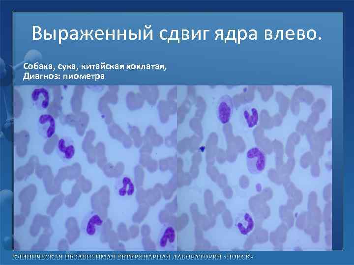 Выраженный сдвиг ядра влево. Собака, сука, китайская хохлатая, Диагноз: пиометра 