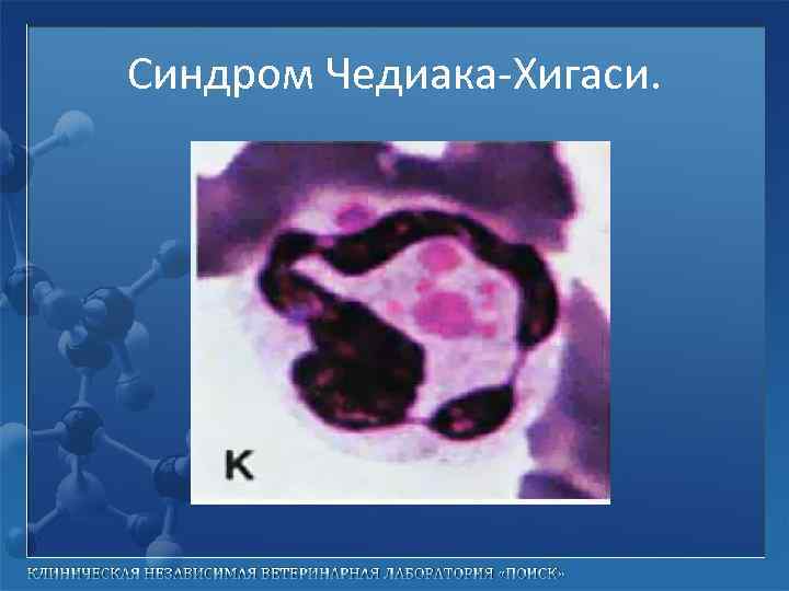 Синдром Чедиака-Хигаси. 