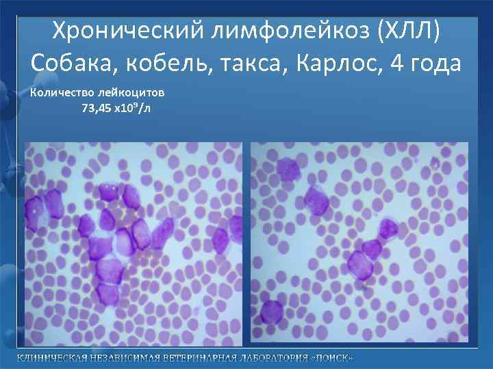 Хронический лимфолейкоз (ХЛЛ) Собака, кобель, такса, Карлос, 4 года Количество лейкоцитов 73, 45 х10⁹/л