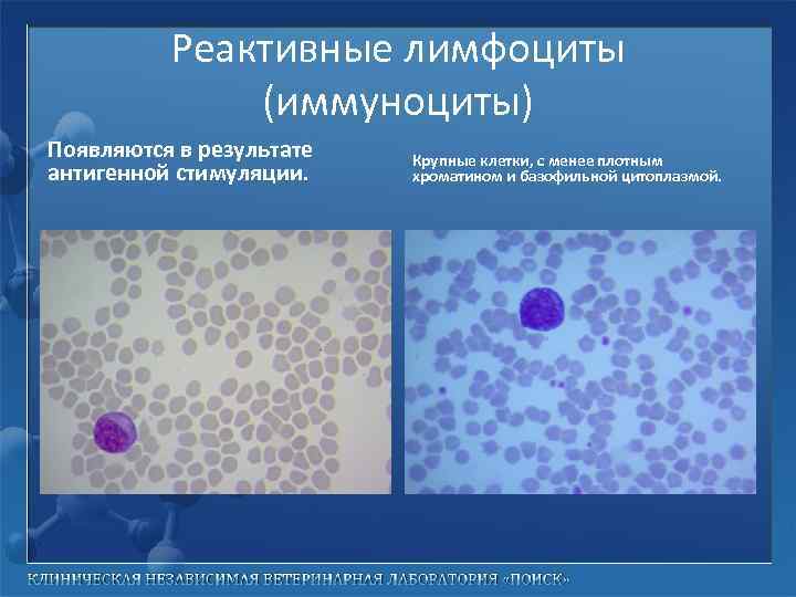 Реактивные лимфоциты (иммуноциты) Появляются в результате антигенной стимуляции. Крупные клетки, с менее плотным хроматином