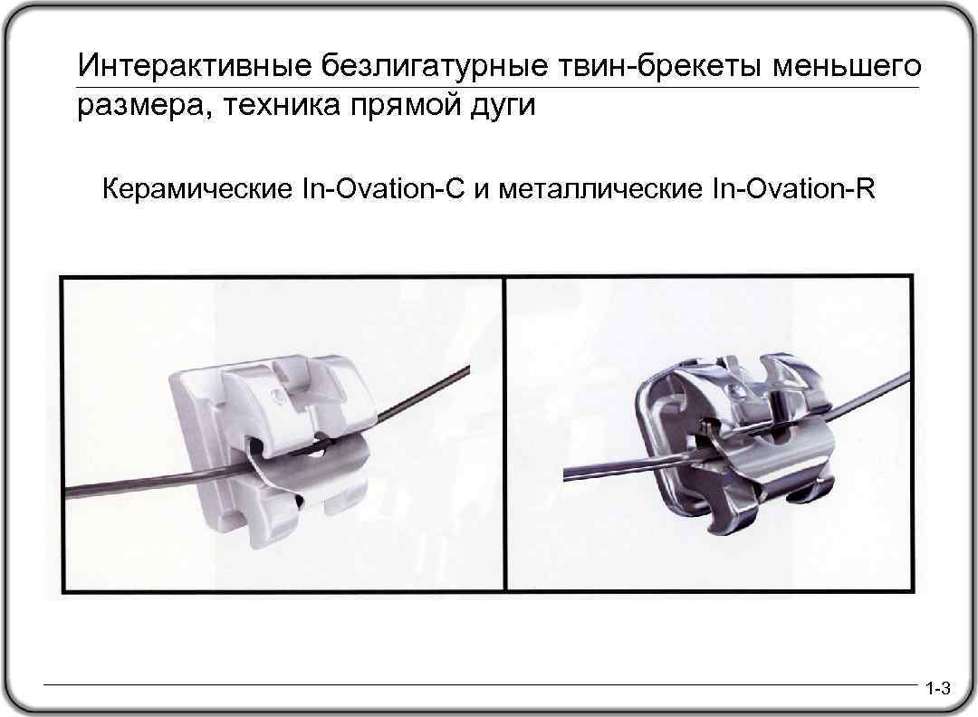 Интерактивные безлигатурные твин-брекеты меньшего размера, техника прямой дуги Керамические In-Ovation-C и металлические In-Ovation-R 1