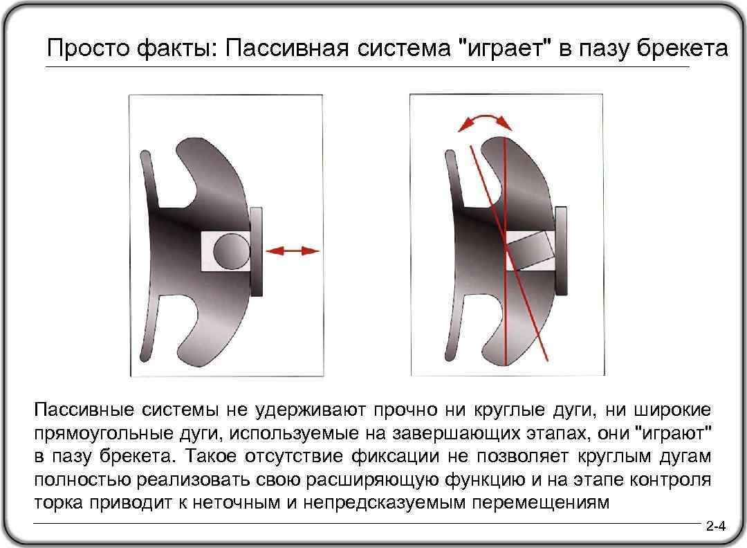 Просто факты: Пассивная система "играет" в пазу брекета Пассивные системы не удерживают прочно ни