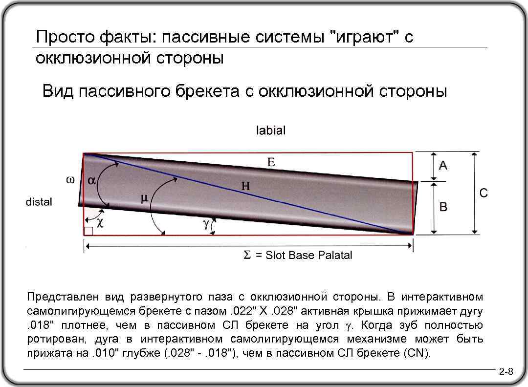 Просто факты: пассивные системы "играют" с окклюзионной стороны Вид пассивного брекета с окклюзионной стороны