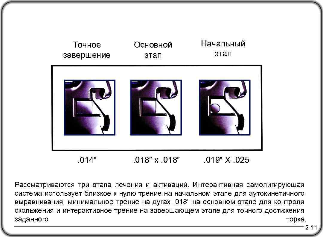 Точное завершение Основной этап Начальный этап . 014” . 018” x. 018” . 019”